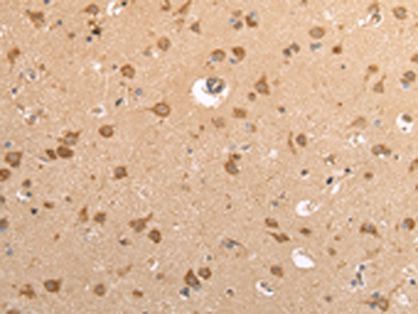 Anti-VAMP4 Rabbit Polyclonal Antibody