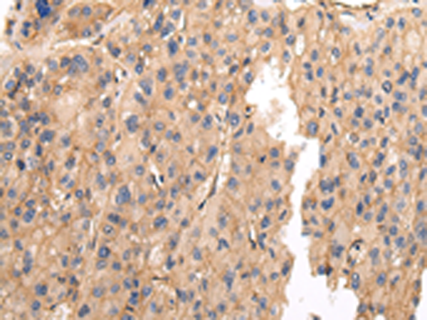 Anti-VAMP5 Rabbit Polyclonal Antibody
