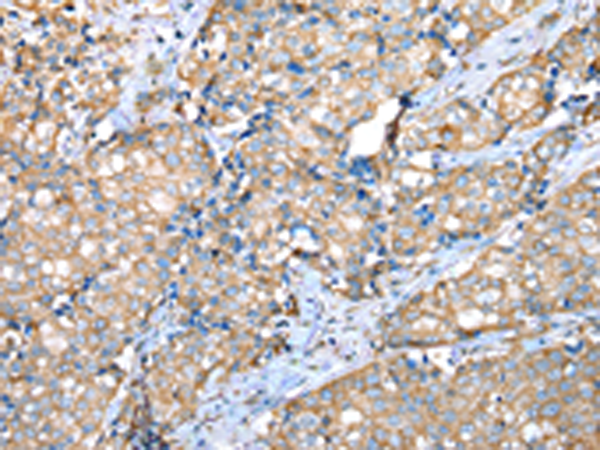 Anti-VAPA Rabbit Polyclonal Antibody