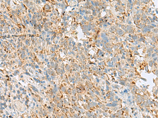 Anti-VDAC3 Rabbit Polyclonal Antibody