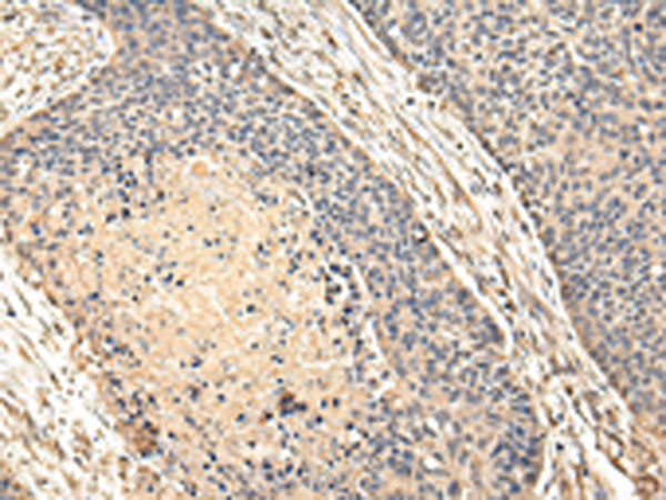 Anti-VPS28 Rabbit Polyclonal Antibody
