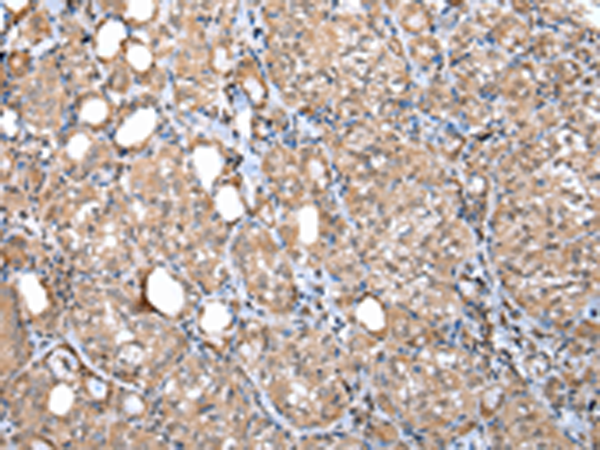 Anti-WDR45 Rabbit Polyclonal Antibody