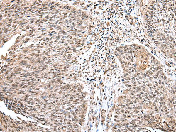 Anti-WDR18 Rabbit Polyclonal Antibody