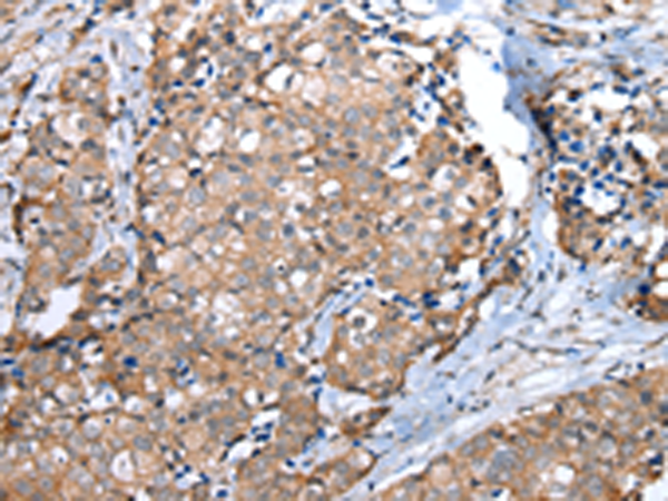 Anti-WFDC5 Rabbit Polyclonal Antibody
