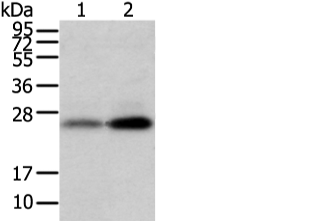 Anti-WFDC5 Rabbit Polyclonal Antibody