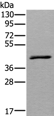 Anti-WSB2 Rabbit Polyclonal Antibody