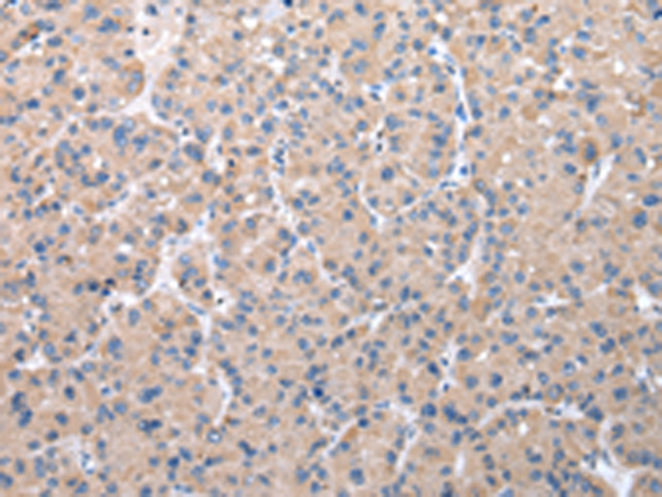 Anti-ZDHHC20 Rabbit Polyclonal Antibody