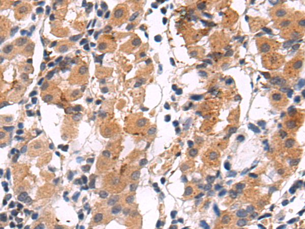 Anti-ZFAND3 Rabbit Polyclonal Antibody