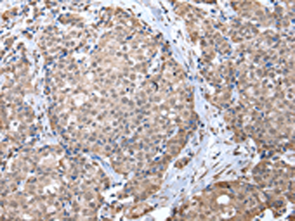 Anti-ZFP91 Rabbit Polyclonal Antibody