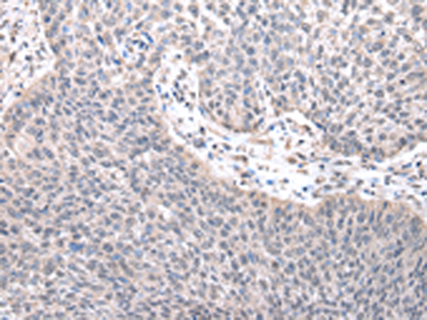 Anti-ZNF239 Rabbit Polyclonal Antibody