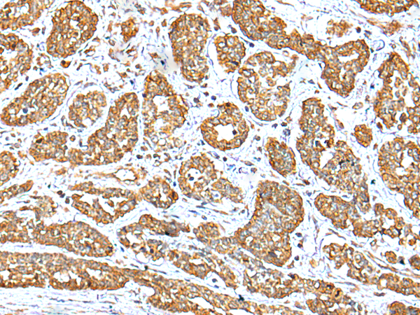 Anti-NDUFB10 Rabbit Polyclonal Antibody