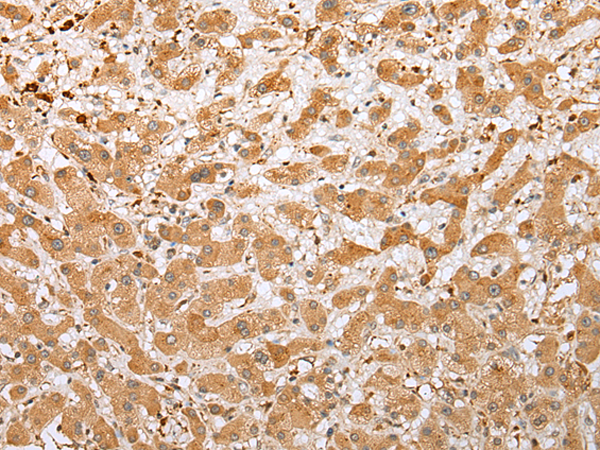 Anti-NDUFB3 Rabbit Polyclonal Antibody