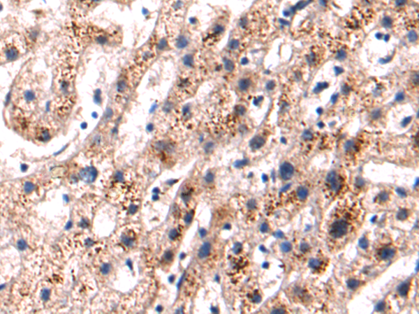 Anti-PCID2 Rabbit Polyclonal Antibody