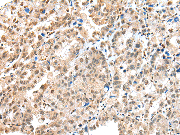 Anti-S100A16 Rabbit Polyclonal Antibody