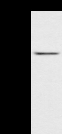 Anti-ACBD4 Rabbit Polyclonal Antibody