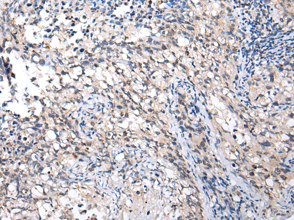 Anti-MMGT1 Rabbit Polyclonal Antibody