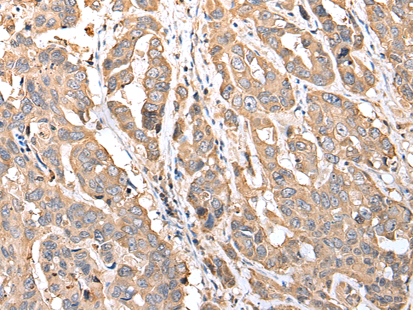 Anti-MRPS18C Rabbit Polyclonal Antibody