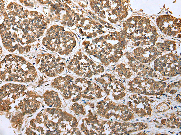 Anti-ATXN7L3 Rabbit Polyclonal Antibody