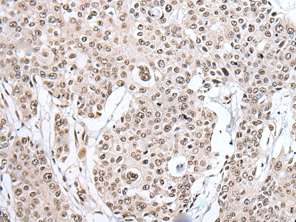 Anti-hnRNP H2 Rabbit Polyclonal Antibody