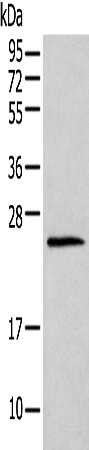 Anti-HIST1H1T Rabbit Polyclonal Antibody