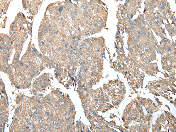 Anti-C8G Rabbit Polyclonal Antibody