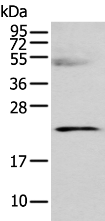 Anti-C8G Rabbit Polyclonal Antibody