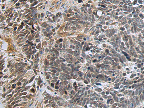 Anti-TGF beta Regulator 1 Rabbit Polyclonal Antibody