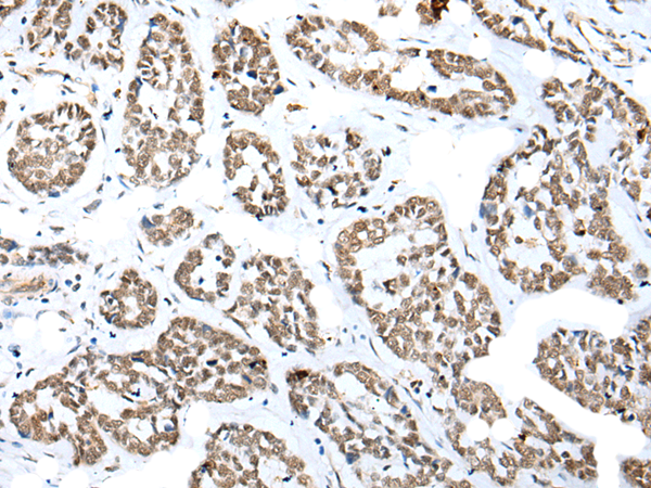 Anti-NUDT21 Rabbit Polyclonal Antibody