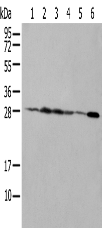 Anti-NUDT21 Rabbit Polyclonal Antibody