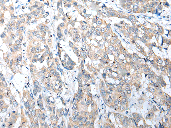 Anti-NUDT22 Rabbit Polyclonal Antibody