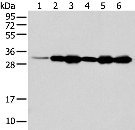 Anti-NUDT22 Rabbit Polyclonal Antibody
