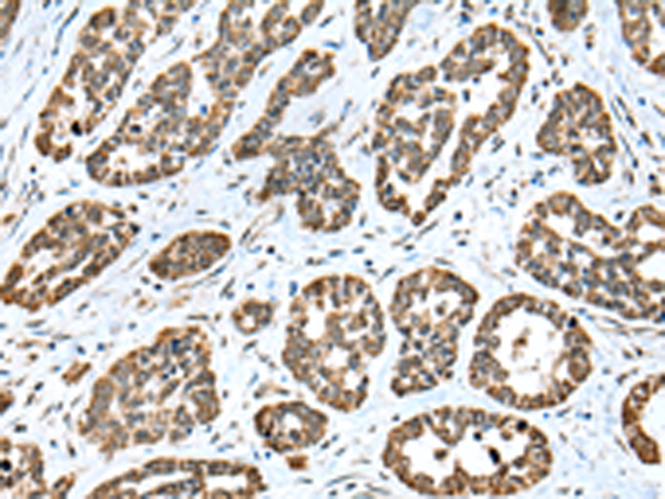 Anti-CAPS2 Rabbit Polyclonal Antibody
