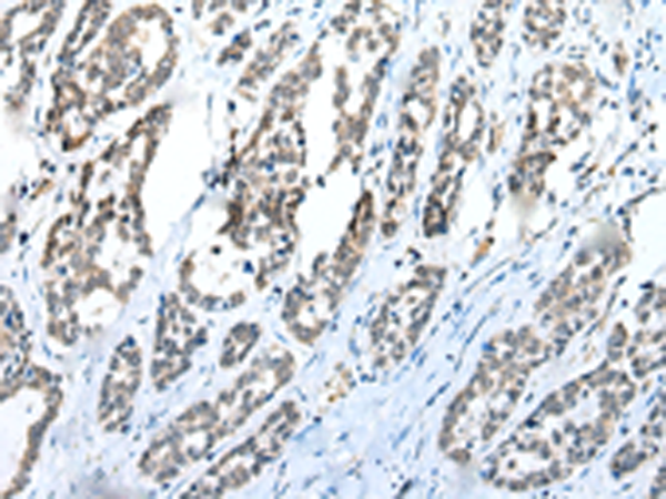 Anti-C1QTNF3 Rabbit Polyclonal Antibody