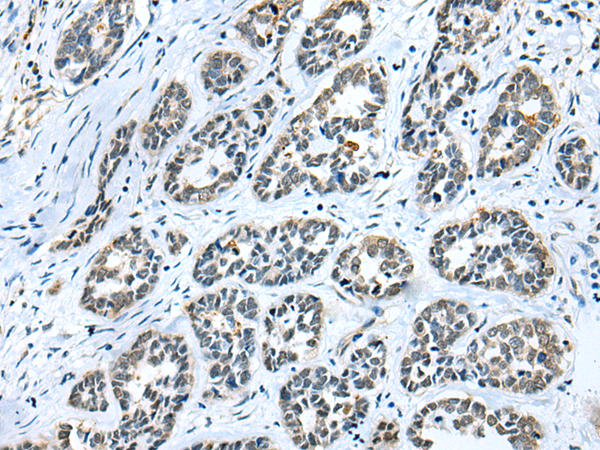 Anti-GMFB Rabbit Polyclonal Antibody