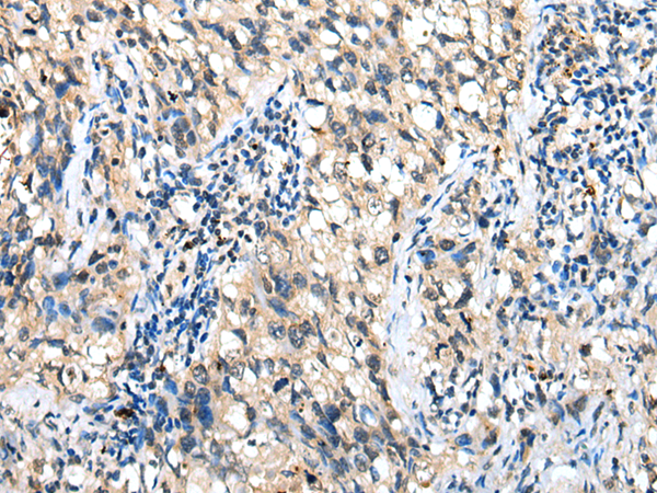 Anti-DHRSX Rabbit Polyclonal Antibody