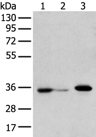 Anti-DHRSX Rabbit Polyclonal Antibody
