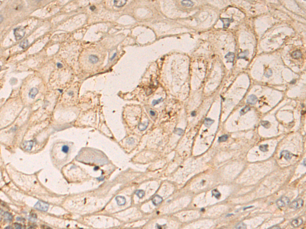 Anti-LSAMP Rabbit Polyclonal Antibody