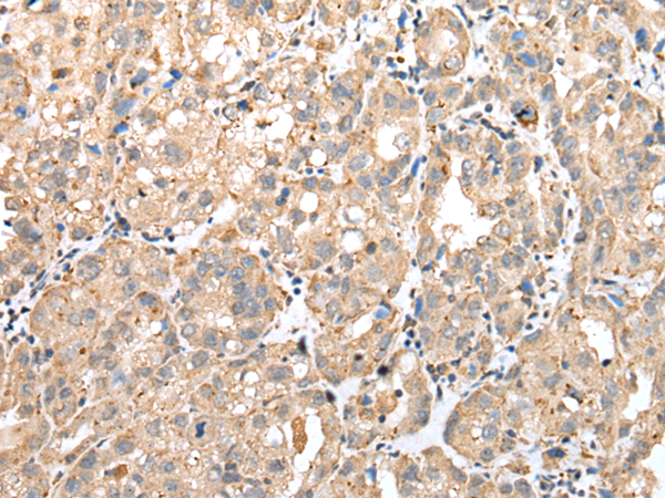Anti-GM2A Rabbit Polyclonal Antibody