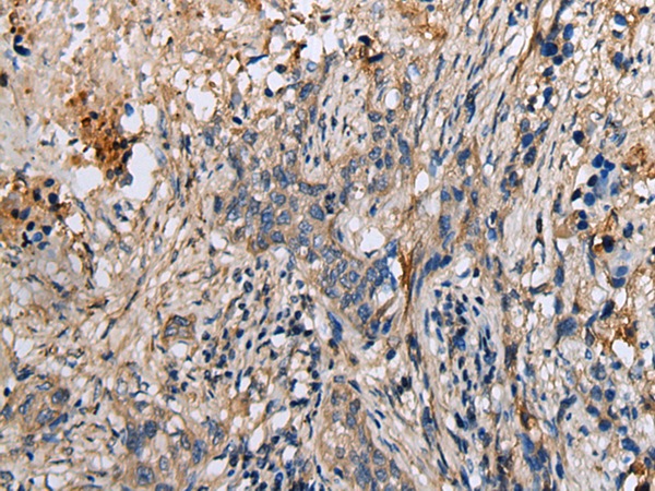 Anti-DENR Rabbit Polyclonal Antibody