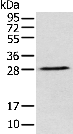 Anti-DENR Rabbit Polyclonal Antibody