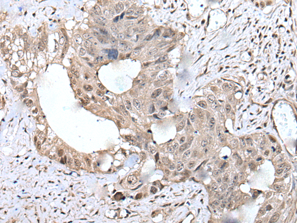 Anti-COMMD10 Rabbit Polyclonal Antibody