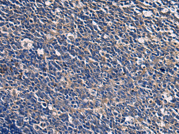 Anti-ABHD14B Rabbit Polyclonal Antibody