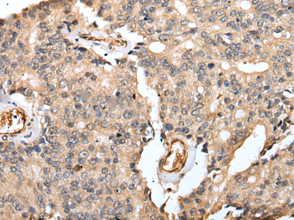 Anti-Rab39B Rabbit Polyclonal Antibody