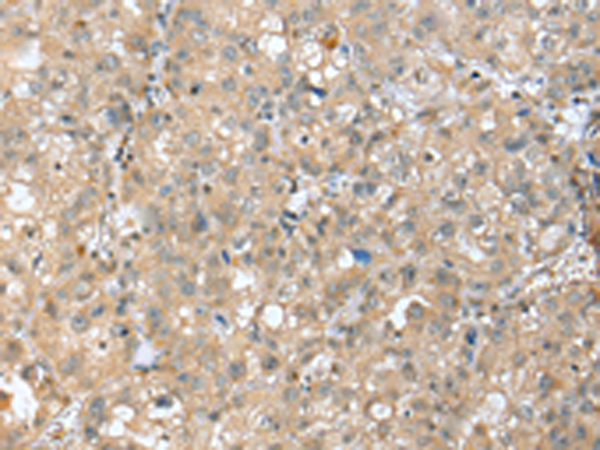 Anti-SETD3 Rabbit Polyclonal Antibody