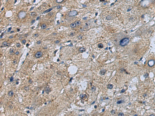 Anti-TINAGL1 Rabbit Polyclonal Antibody