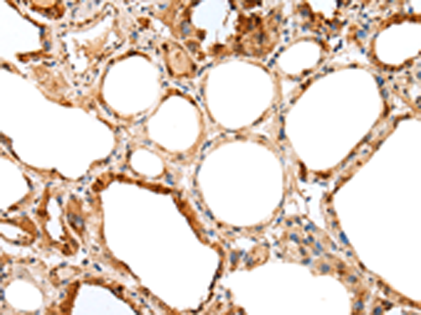 Anti-GSTM4 Rabbit Polyclonal Antibody