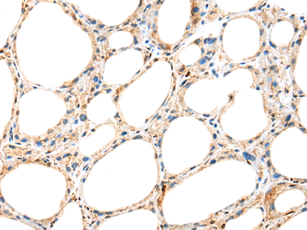 Anti-NUDCD3 Rabbit Polyclonal Antibody