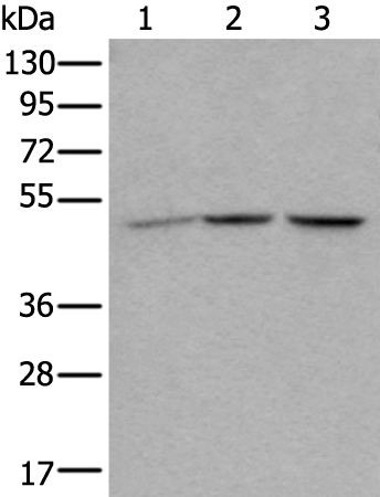 Anti-NUDCD3 Rabbit Polyclonal Antibody