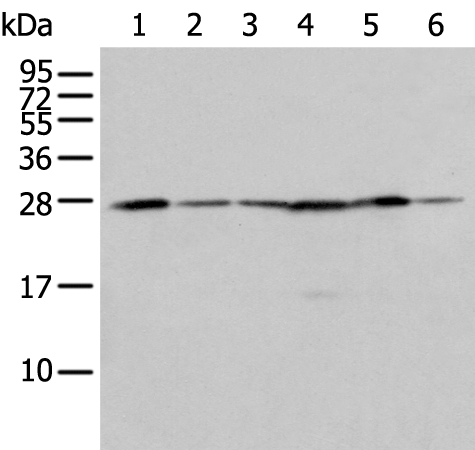 Anti-FKBP7 Rabbit Polyclonal Antibody