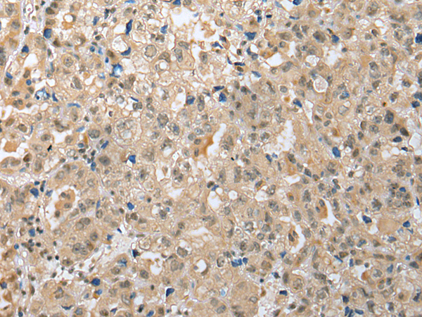 Anti-ZNF22 Rabbit Polyclonal Antibody